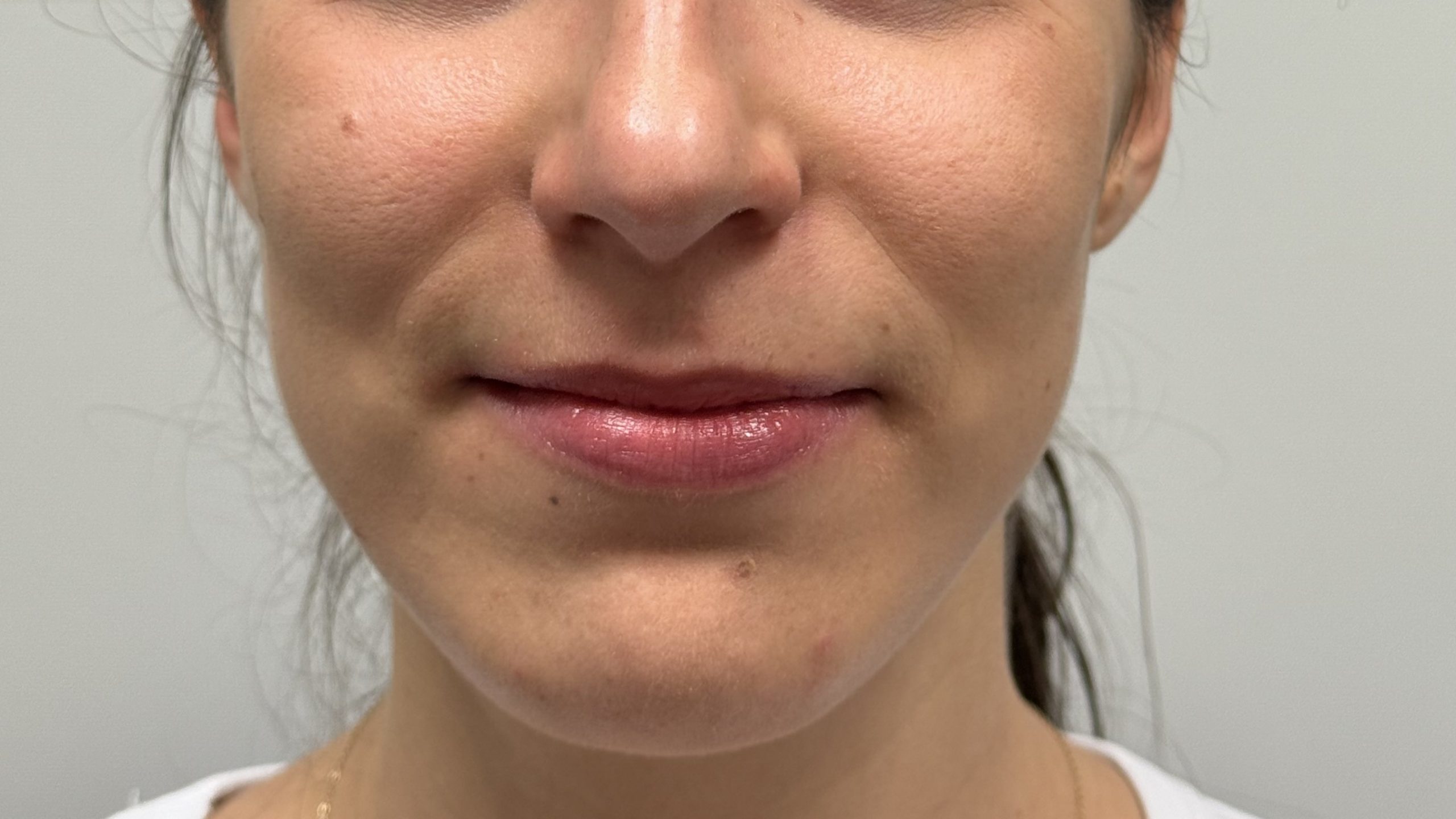 Gesicht nachher von vorne